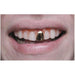 "Scarecrow Gold Cap Teeth For The Perfect Spooky Look"