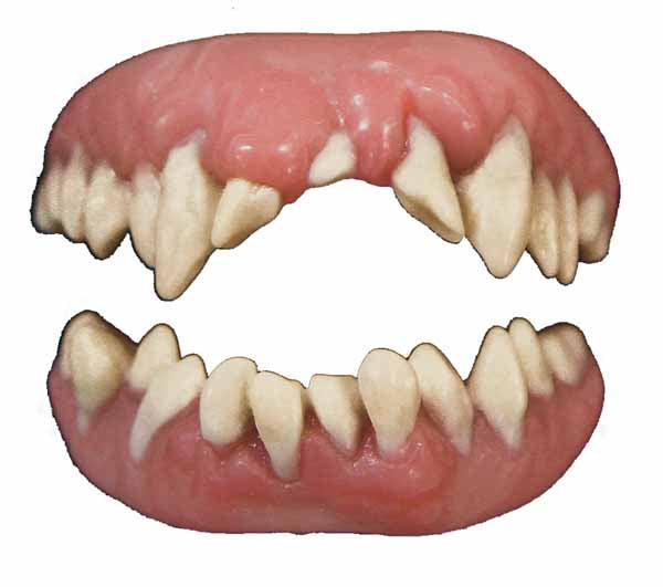 Invasion Teeth Veneers