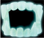 Fun World Glow-in-the-Dark Vampire Fangs